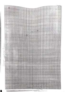 Rate of absorption of glucose from a 5cm long section of small intestine
