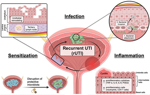 Overcoming challenges in UTI Overcoming challenges in UTI