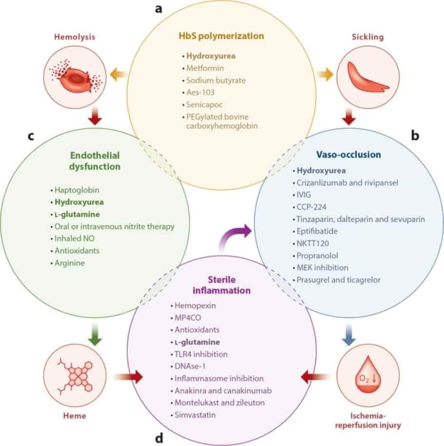Suckle cell Anaemia- Current and Future Therapies