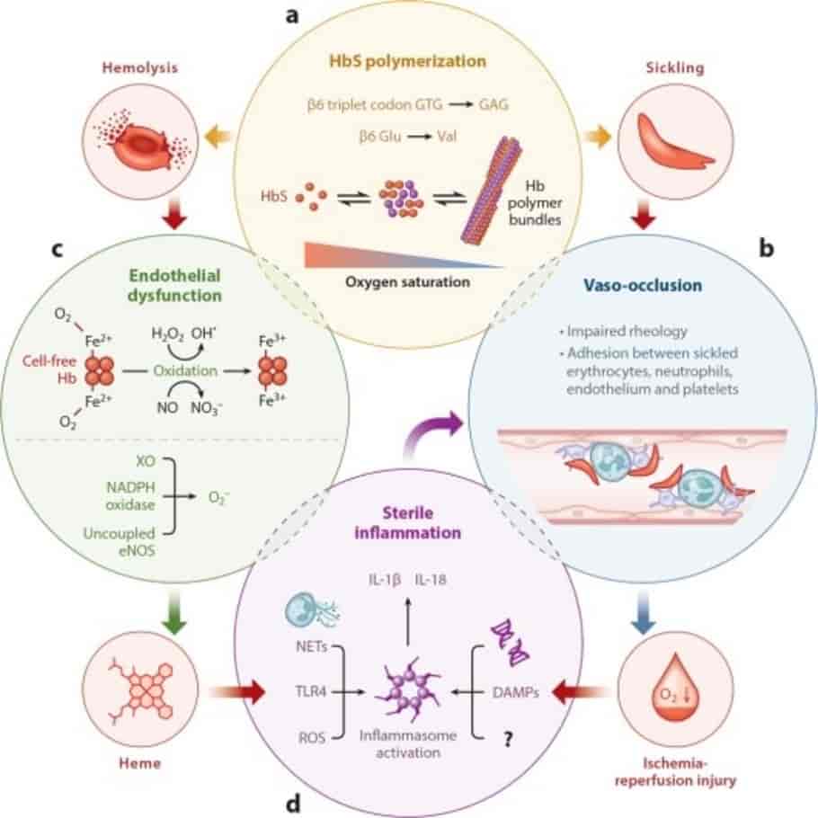 Suckle cell anaemia- Molecular pathophysiology